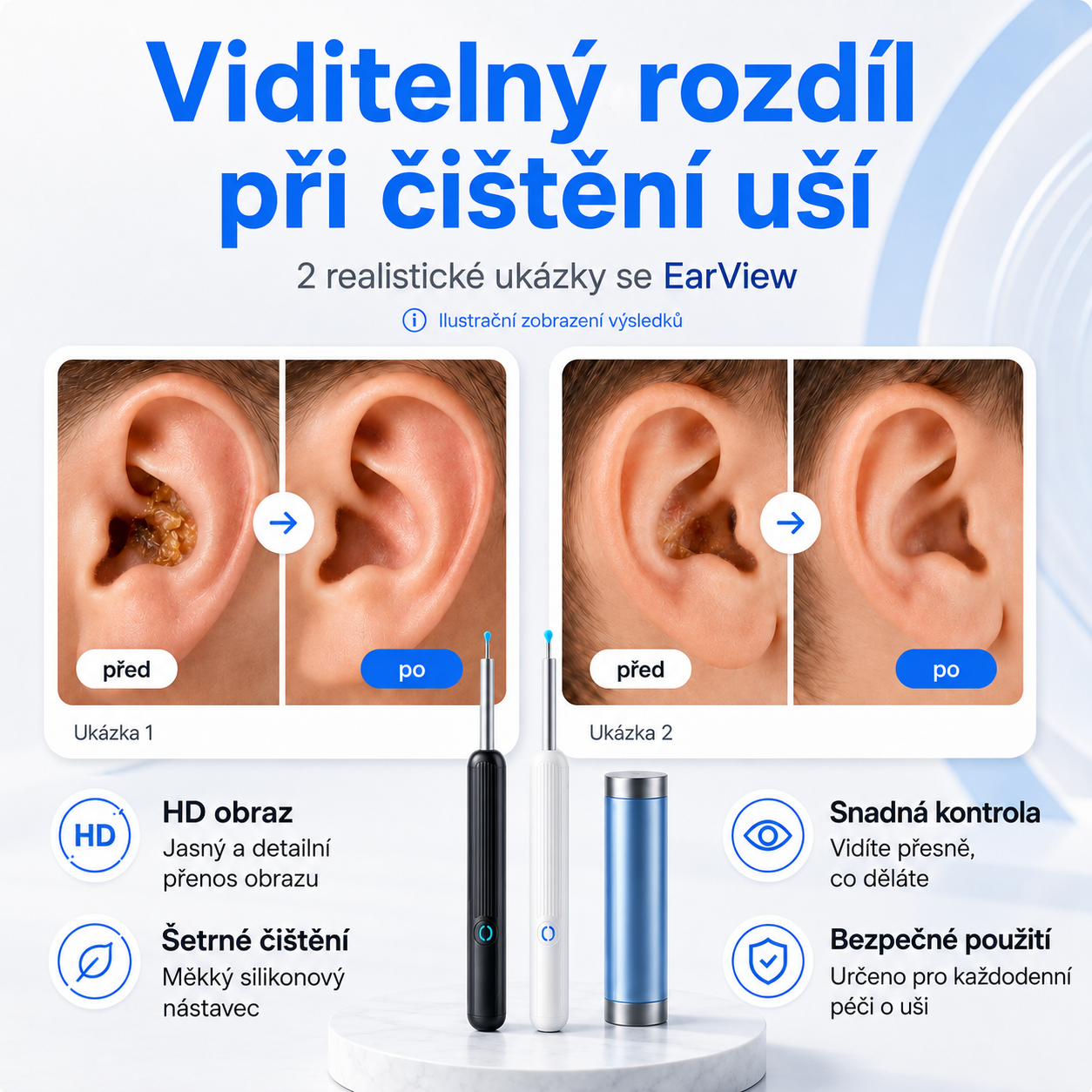 EarView – Chytrá kamera na čištění uší