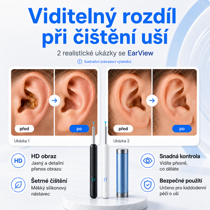 EarView – Chytrá kamera na čištění uší